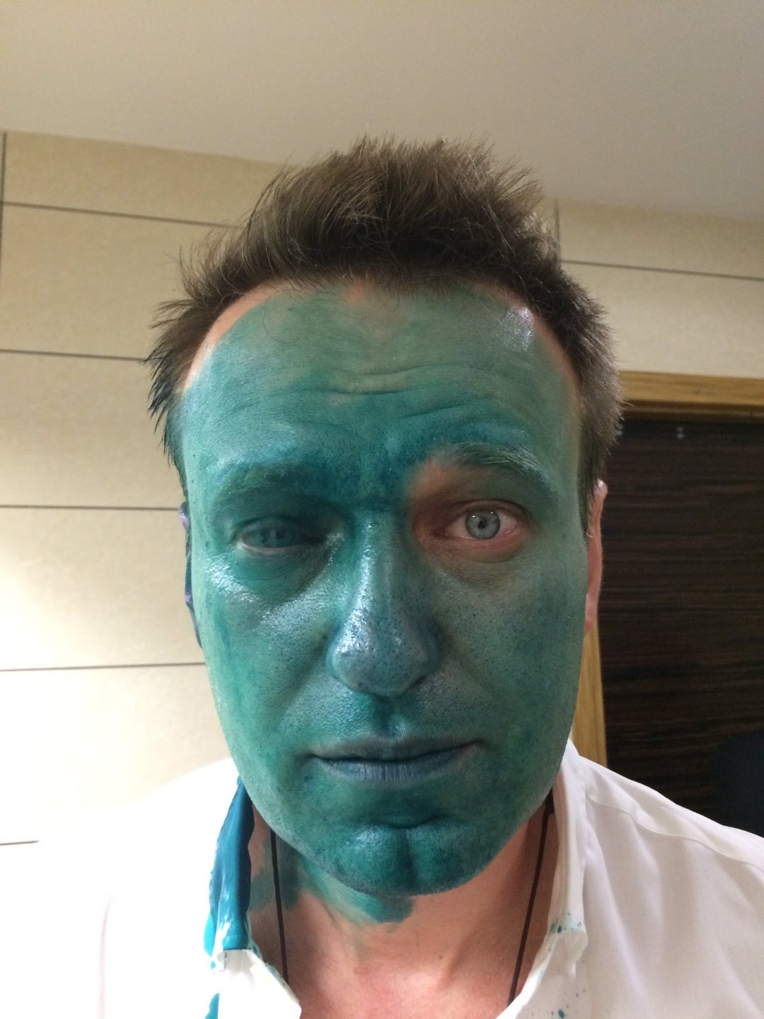 Navalny after being attacked with acid and the Green